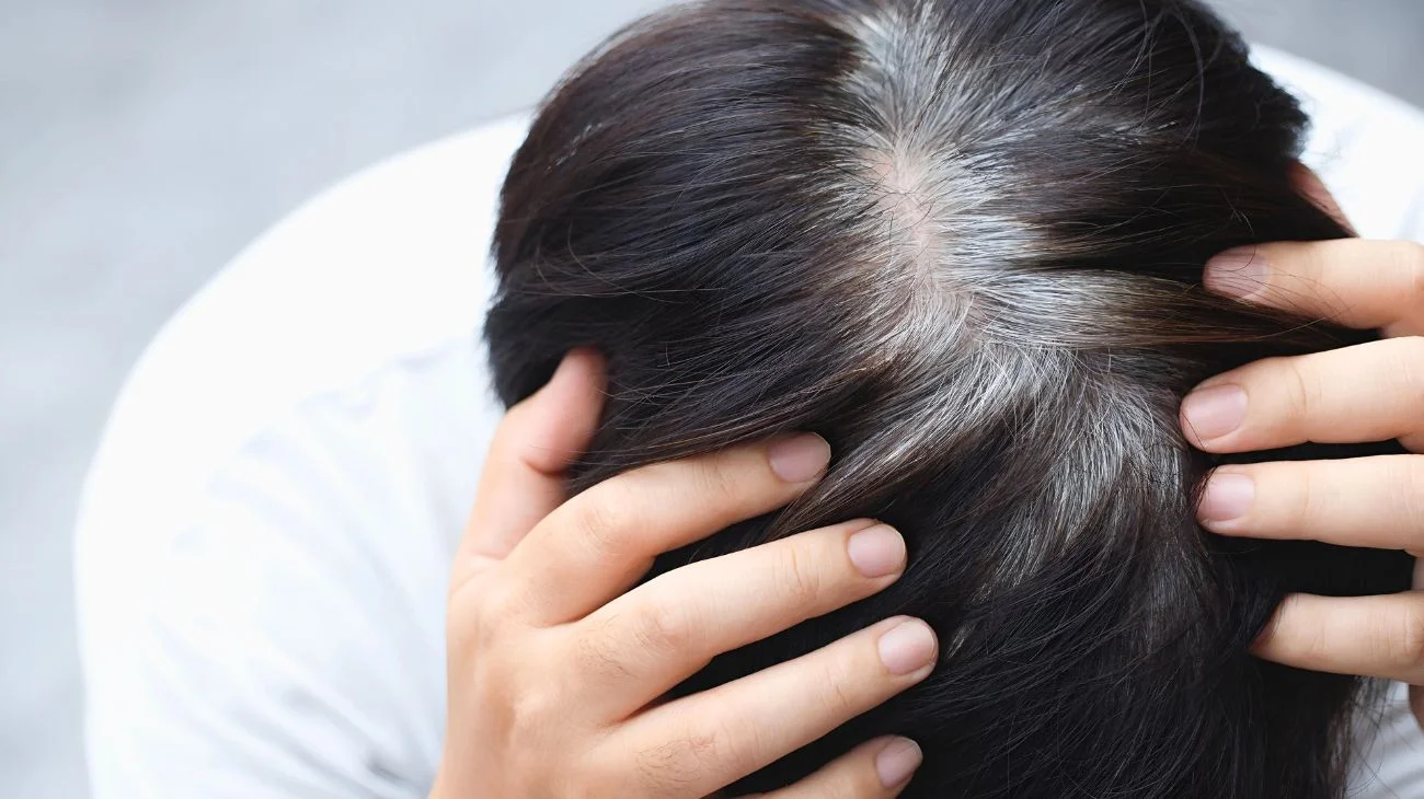 I tre metodi naturali contro i capelli grigi